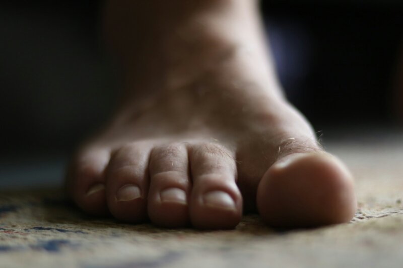 Hidratação profunda para recuperar pés rachados