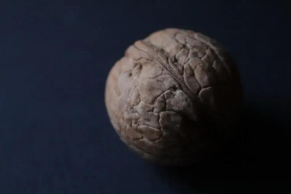 O que causa celulite e como lidar de forma natural